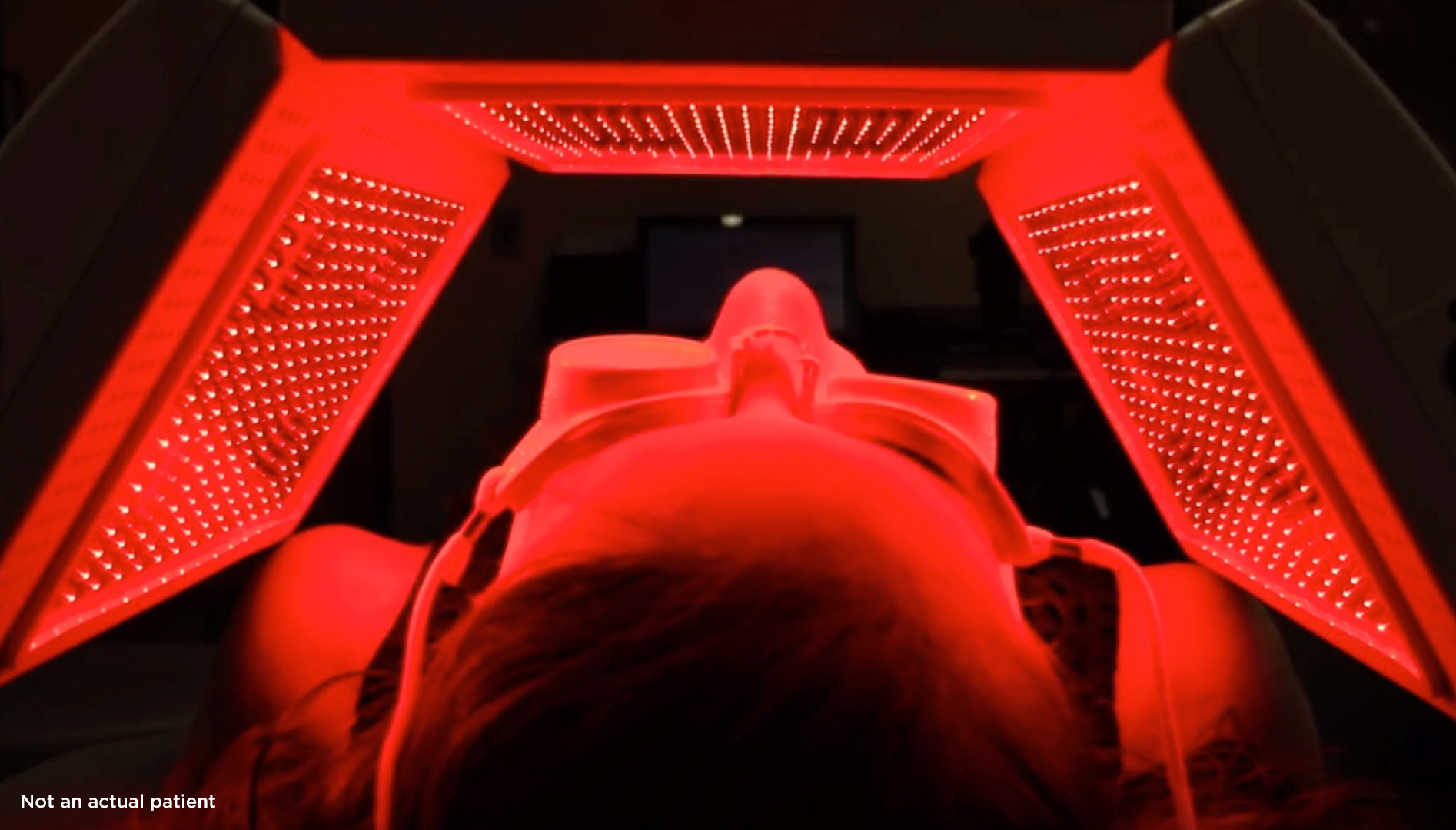 LED Light Therapy Stephen P. Beals, M.D.